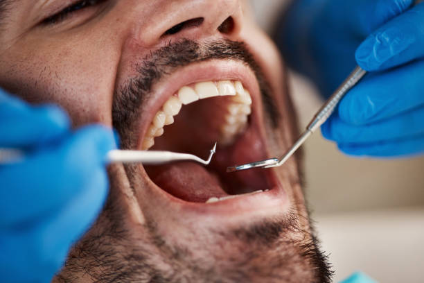 Best Emergency Treatment for Oral Infections in Lanai City, HI