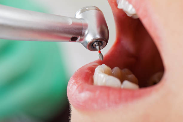 Professional Emergency Dental Service in HI